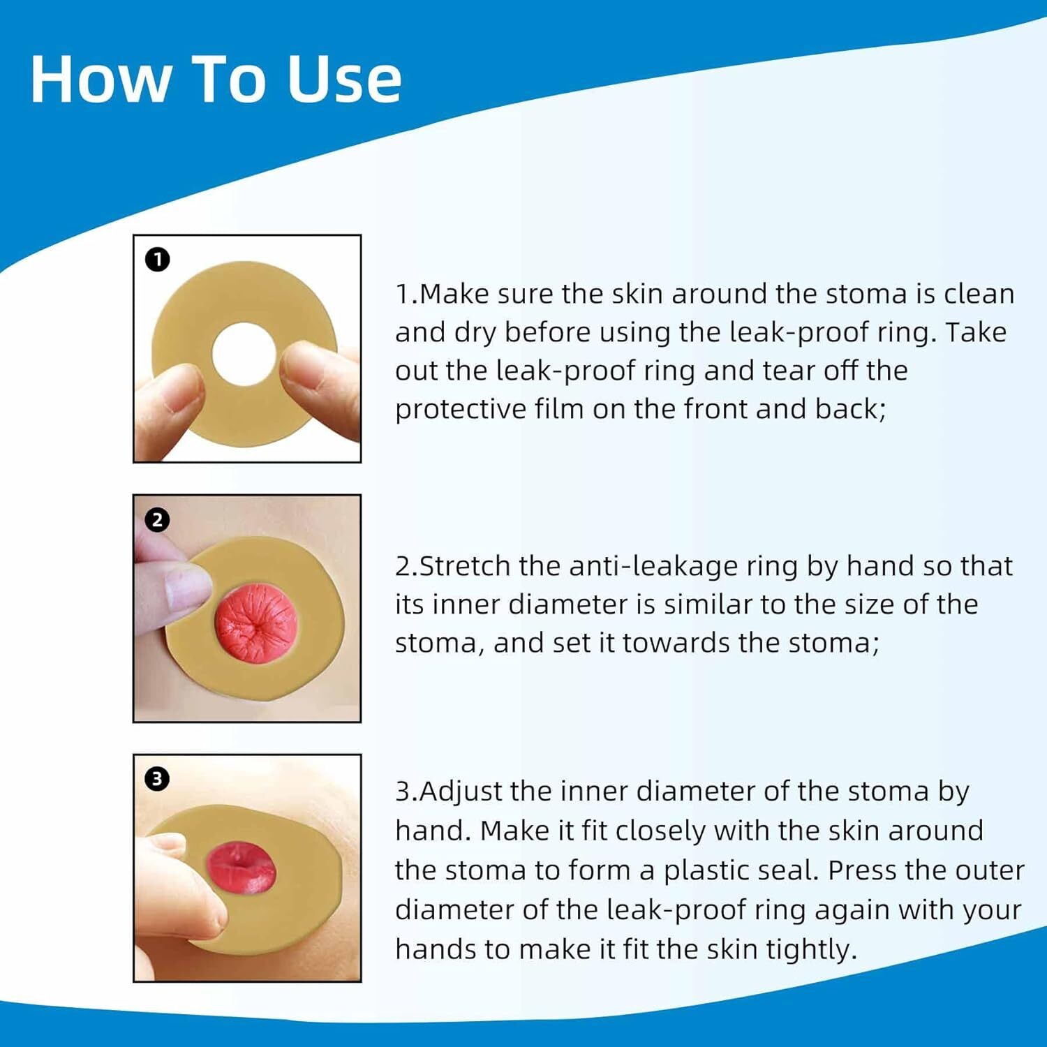 10PCS Ostomy Barrier Rings, Moldable Hydrocolloid for Colostomy Bags