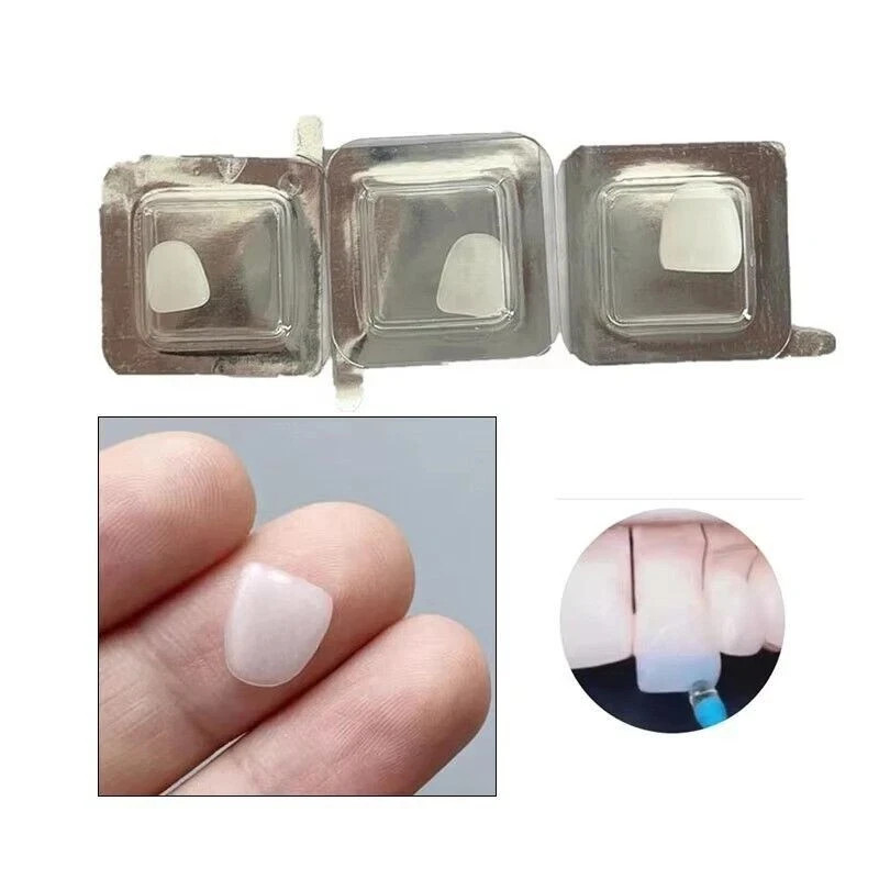 Dental Composite Upper/Lower Resin Light Cure Anterior Teeth Front Teeth Veneers