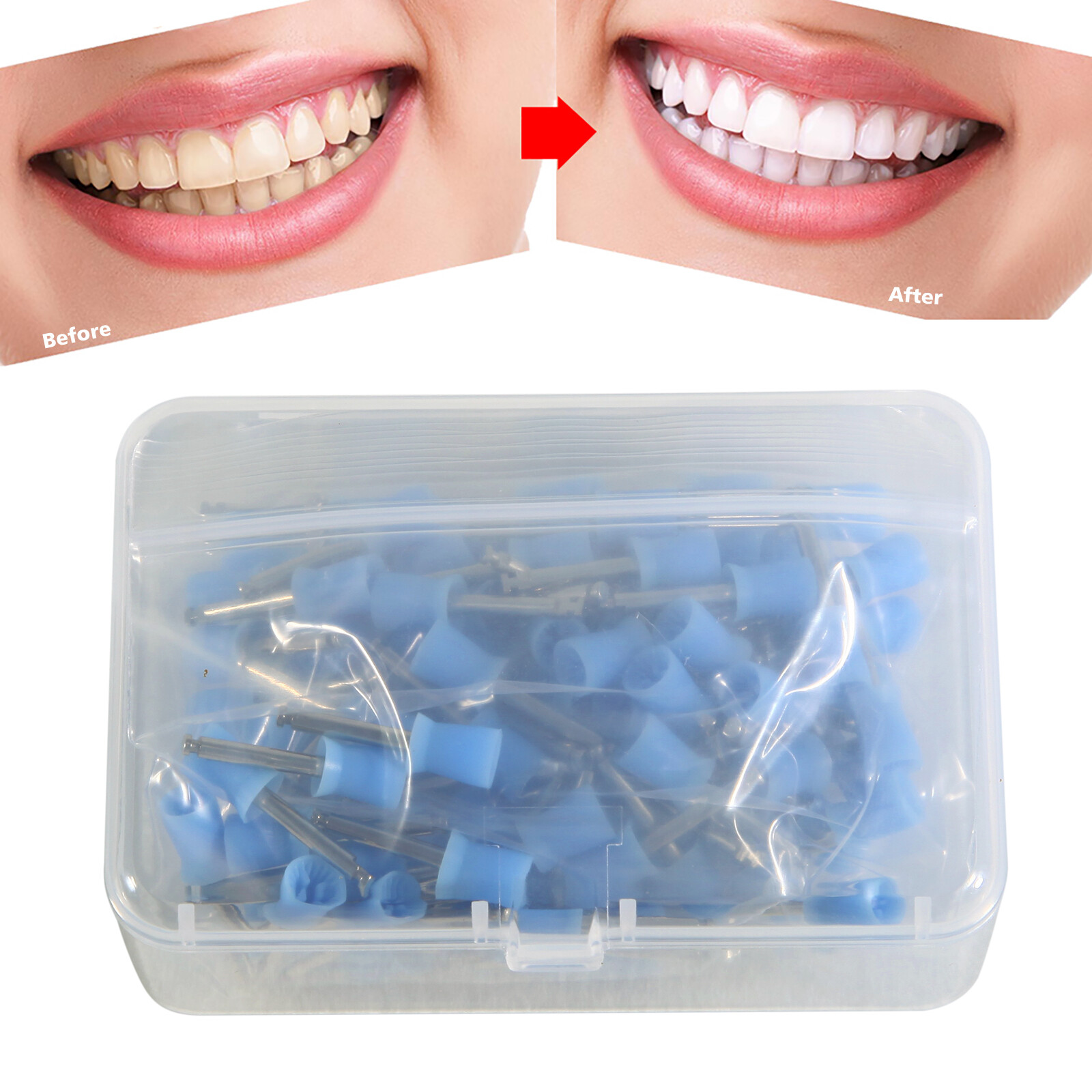 100-1000*Dental Latch Type Tooth Prophy Polishing Cups Polisher Blue/White/Green