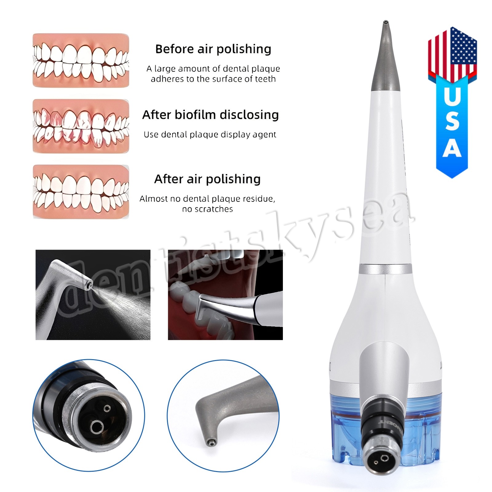 SANDENT Prophy Air Flow Prophy Handpiece Teeth Polishing 4Hole/2Hole