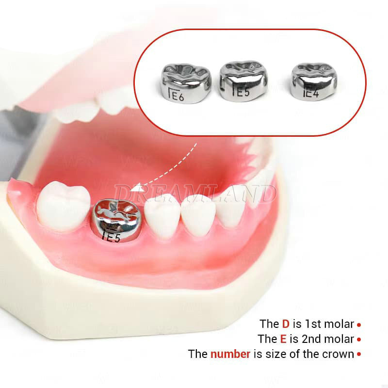 48 ASSORTED PRIMARY MOLAR STAINLESS STEEL CROWNS – COMPLETE KIT