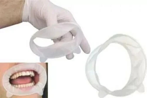 Ivoclar Optragate (Pack Of 40) Free Shipping