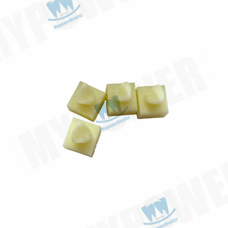 Dental Cavity Preparation/Vitro Decay Caries Model/Composite Resin Filling Model