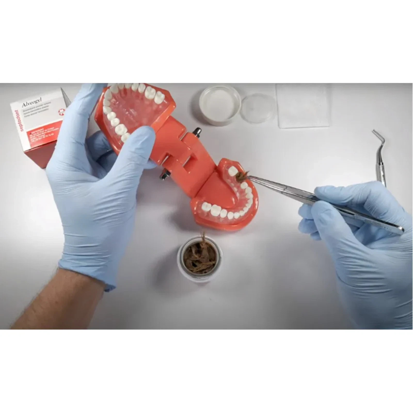 Septodont Alveogyl Dental Dry Socket Paste Alveolitis Dressing Iodoform Eugenol