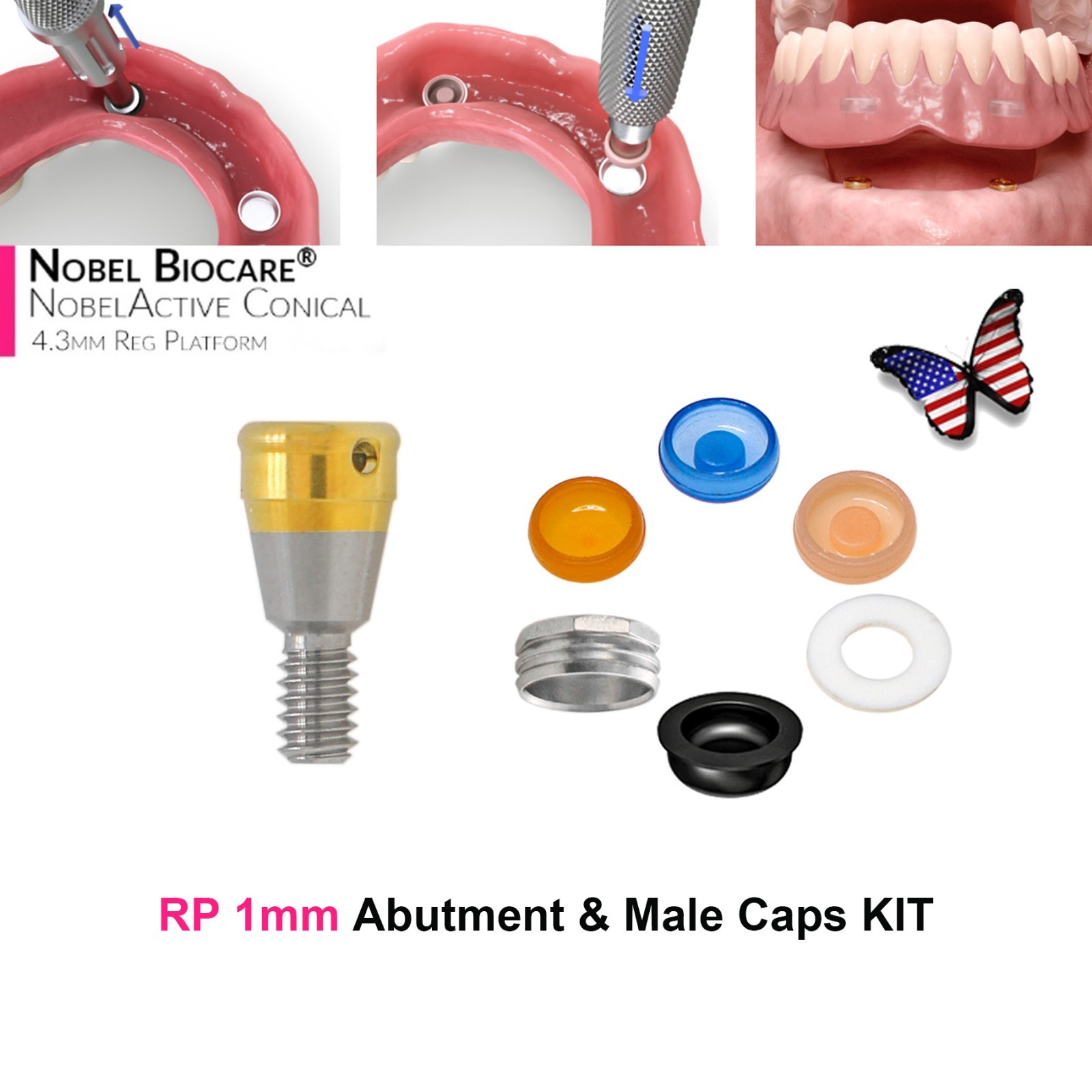US Nobel Active Locator Abutment & Caps Inserts Kit NP/RP 1-5mm PEEK Retention