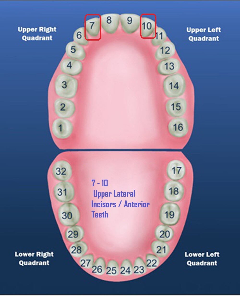 Tooth #7 Upper Right Lateral (URL) Polycarbonate Temporary Crowns Cap Refills