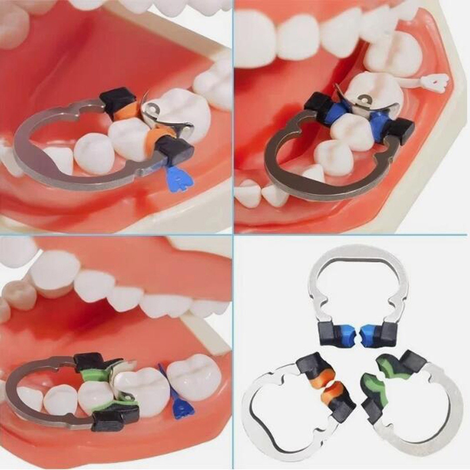 Dental Matrix Bands Ring Kit Sectional Matrice Clamp Garrison Palodent V3 System
