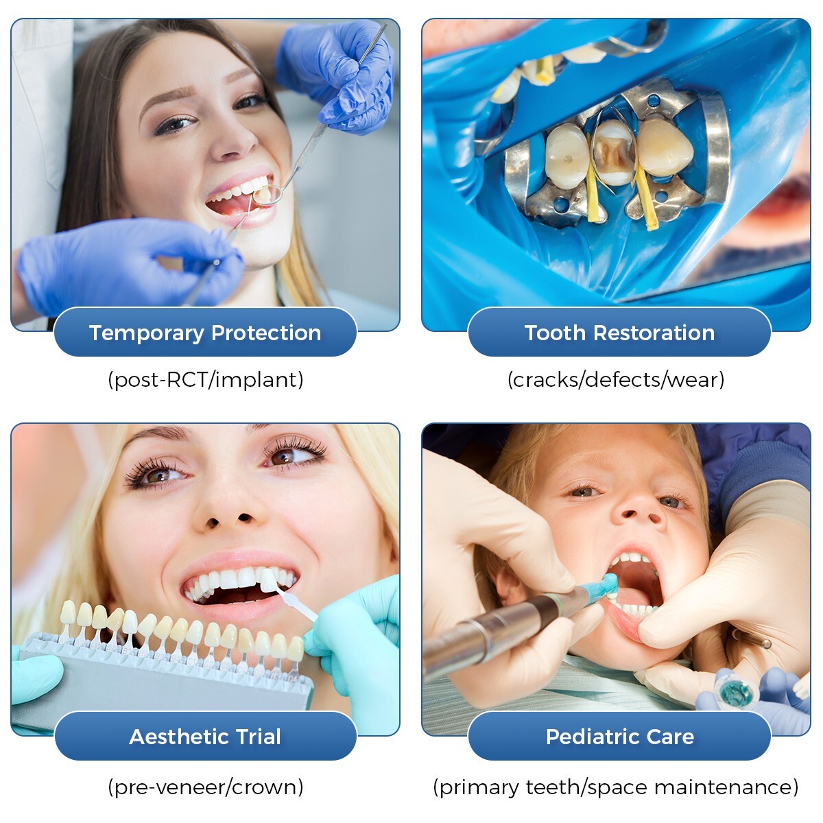 Temporary Resin Crowns Temporarily Repair Missing/Damaged Teeth Restoration