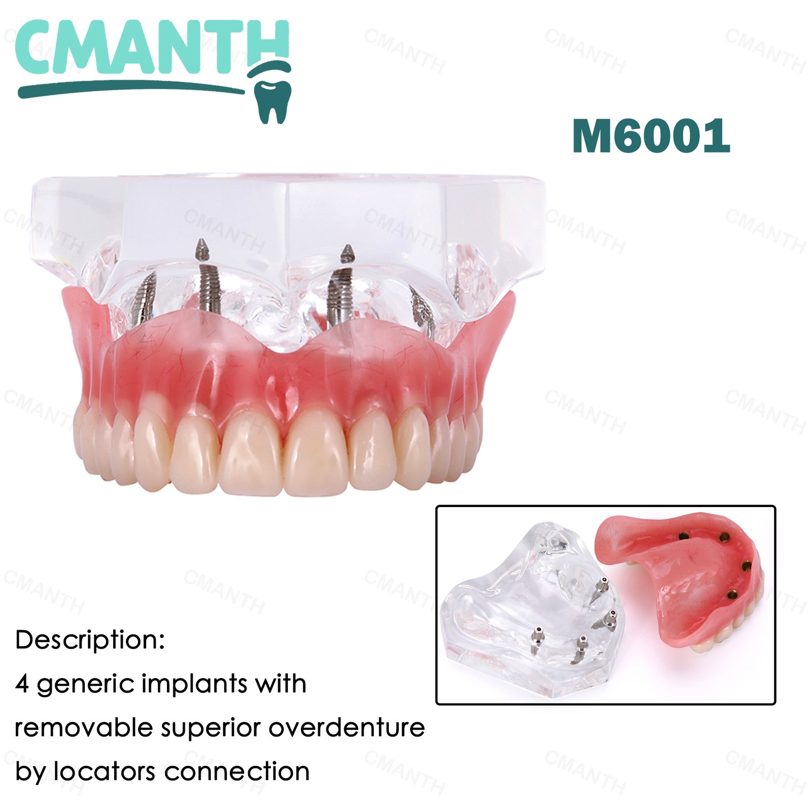 Dental Teeth Model Orthodontic Model Teaching Studying Implant Models Dental Lab