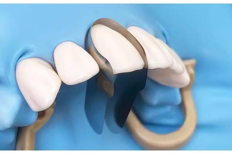 Dental Metal Matrix Bands M8 Sectional Matrix System Matrices Matrix S/M Size