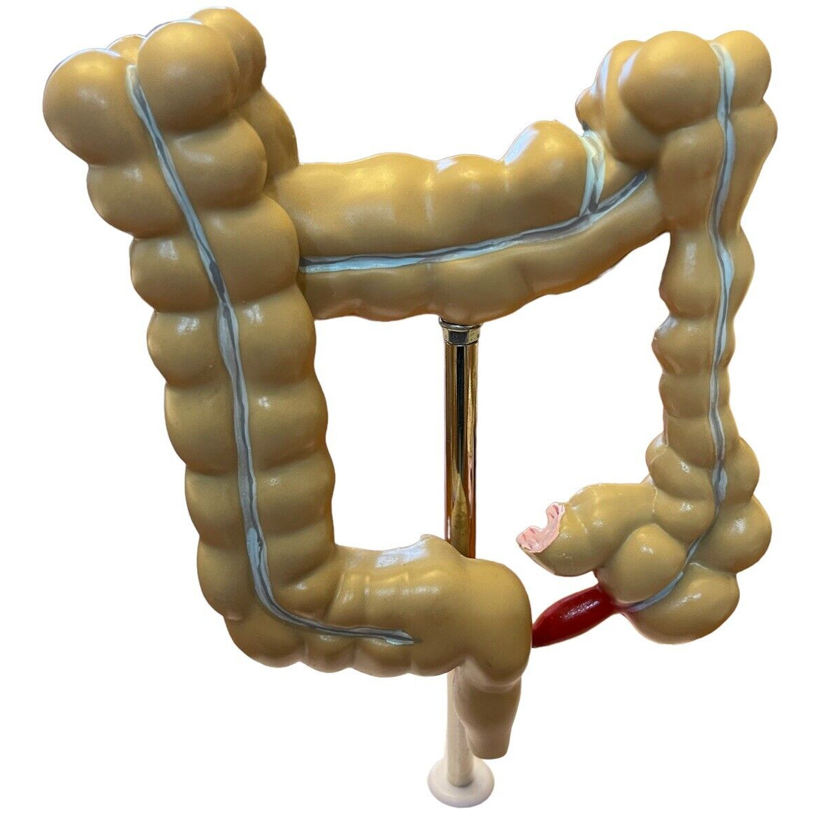 Colon Anatomy Model W Pathologies Medical Human Large Intestine 7.75″ x 6″