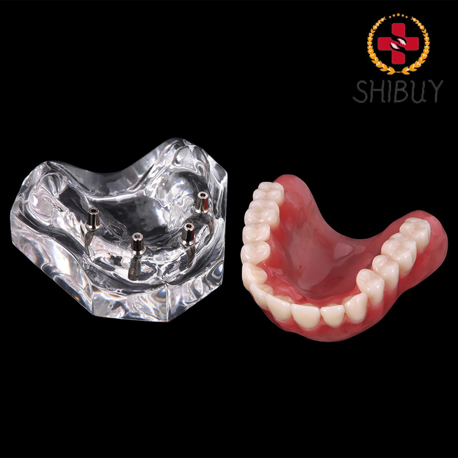 For Upper/Lower Teaching Study Dental Implant Model, Removable Overdenture
