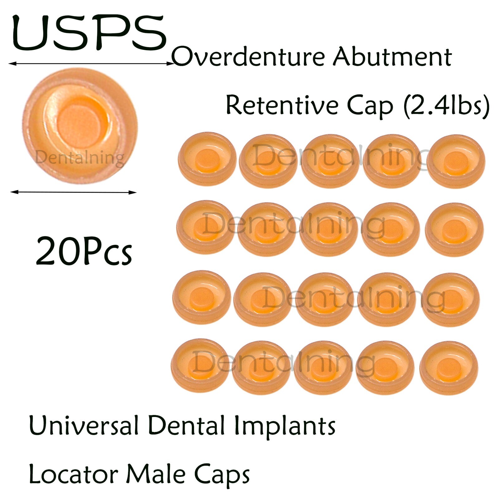 US Dental Universal Locator Overdenture Abutments Retention Caps 1.2/2.4Lbs