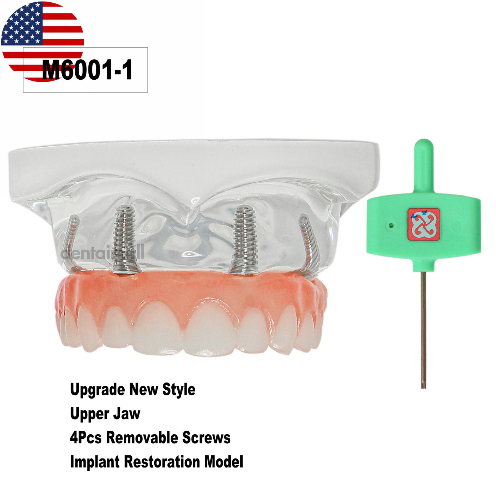 US Dental Overdenture Implant All on 4 Implant Model With 4 Screws Denture Model