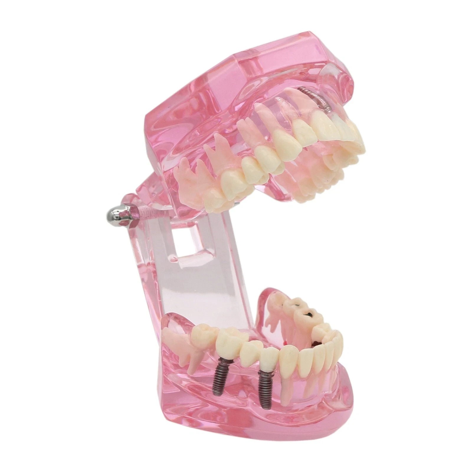 Dental Implant Teeth Model Teach Study Demo Restoration Pathology #2001 Pink