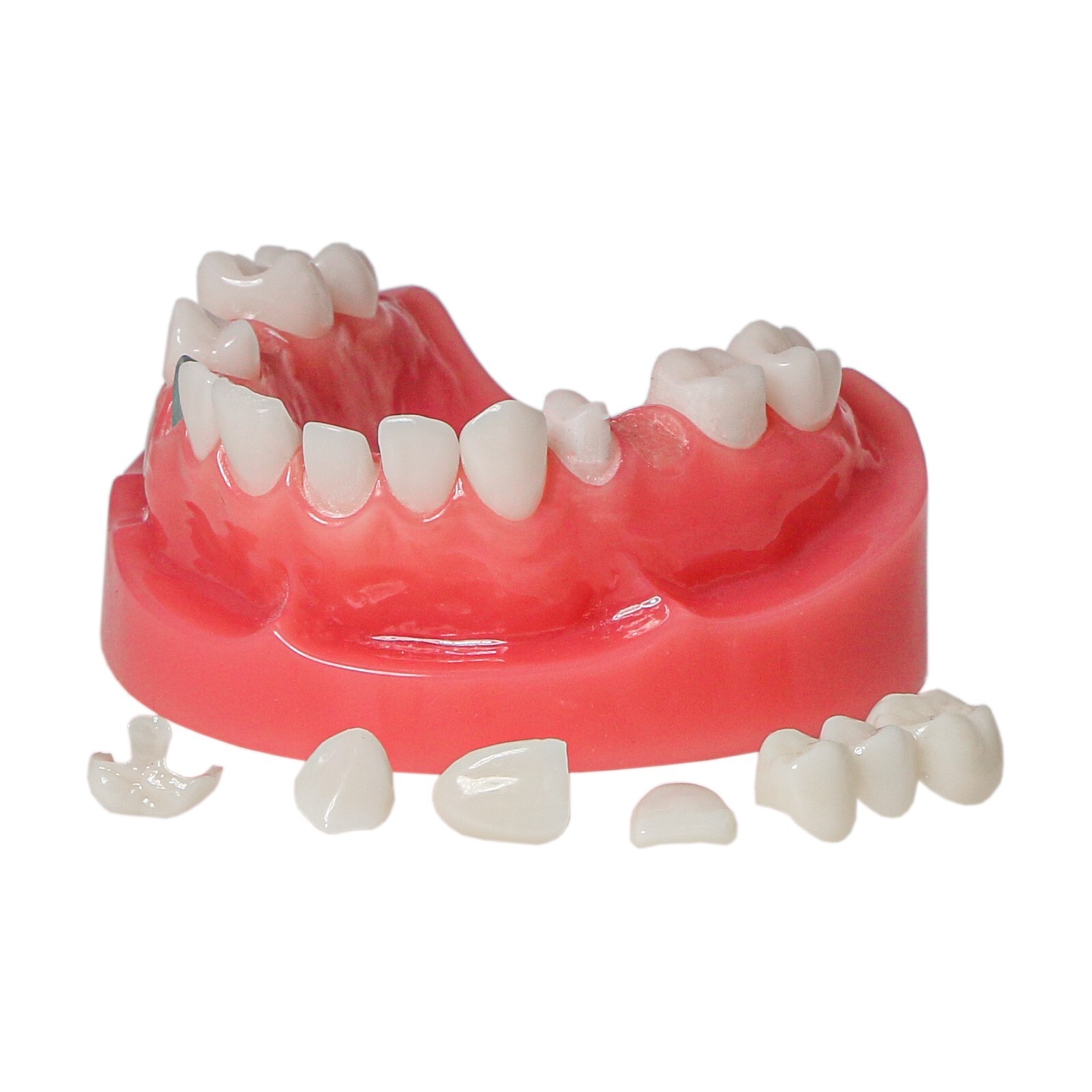 Dental Typodont Teeth Model Implant Pathological Perio Restoration Practice Demo