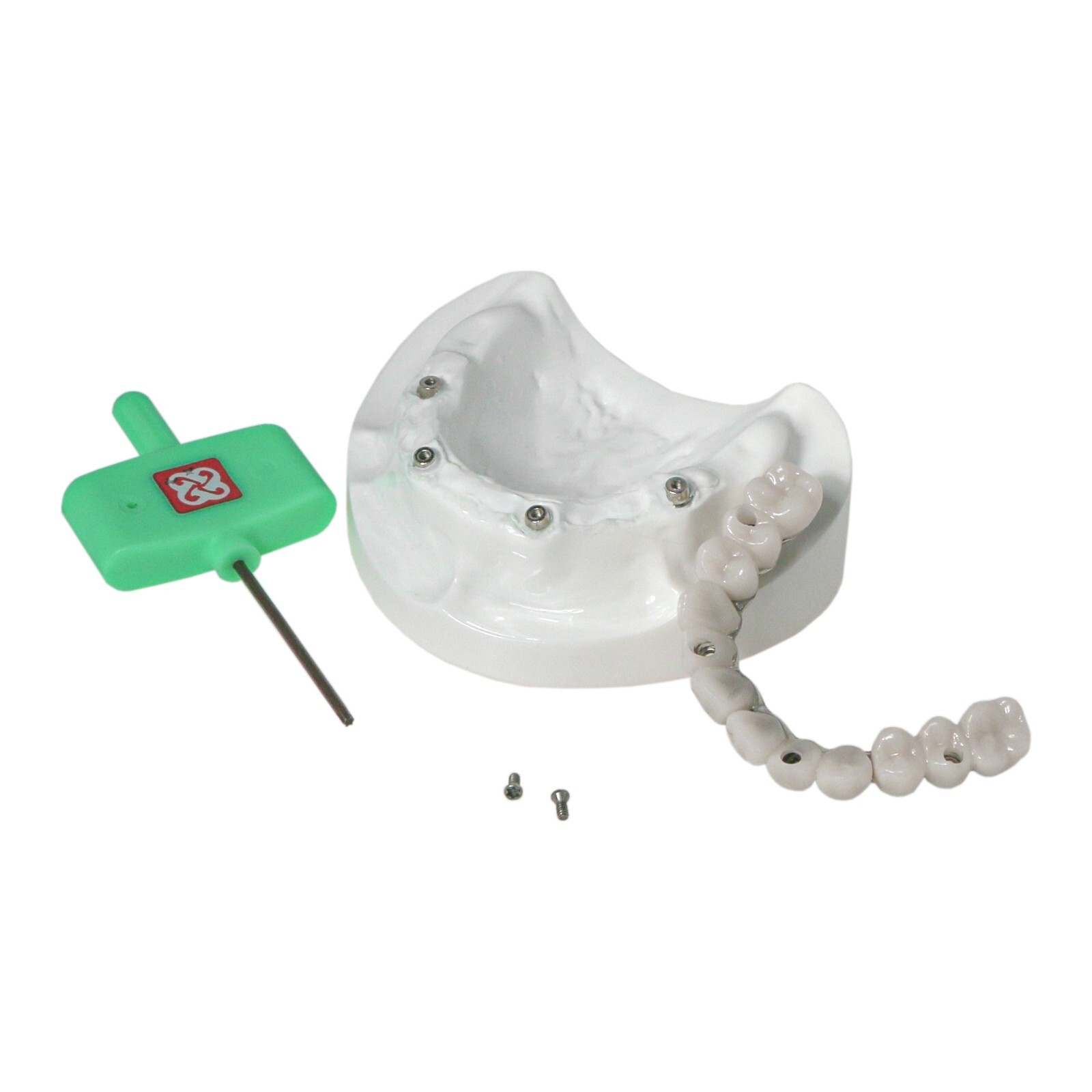 Implants Dental All-on-4 Overdenture Model Upper Jaw Restoration 4 Screws M6023