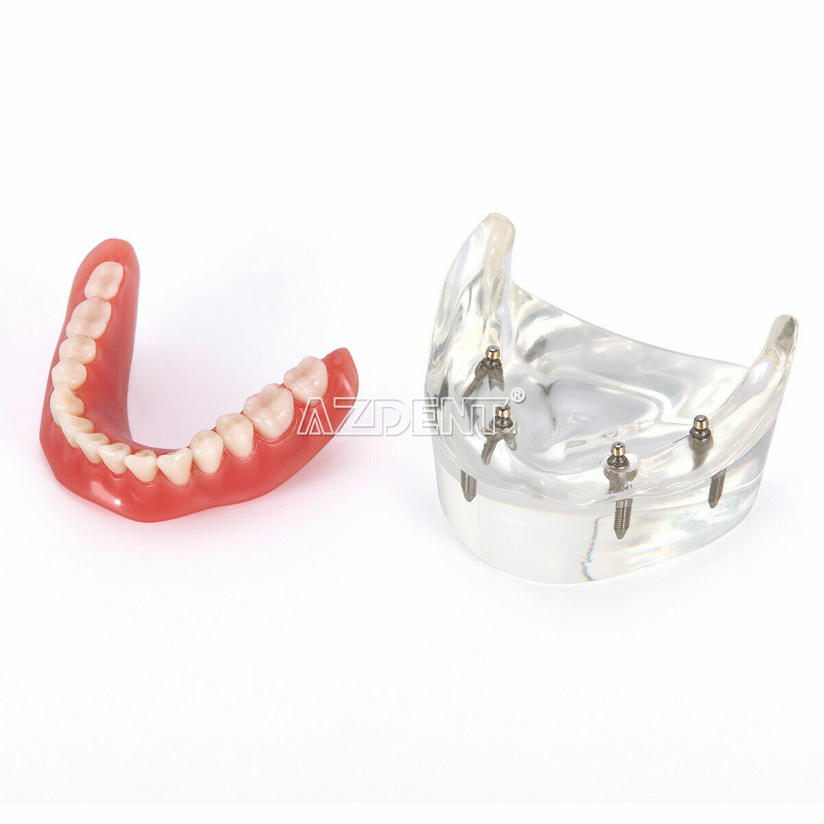 Dental Demonstration 4 Implants Teeth Model Typodont Inferior Overdenture Lower