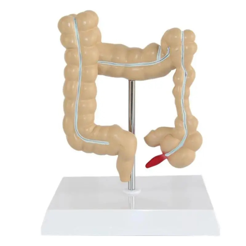 Colorectal Lesion Model Human Colon Large Intestine Pathological Diseases Model