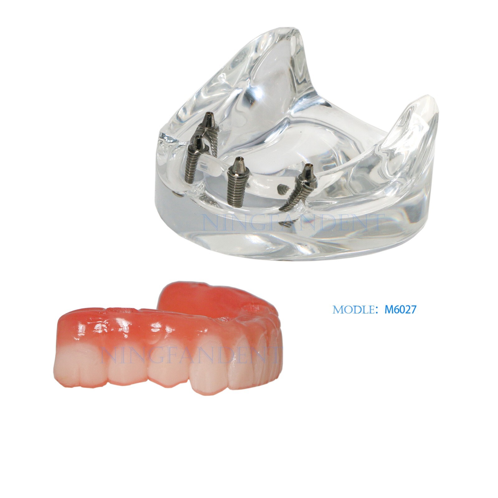 Dental Transparent Lower Jaw Malone Bridge All-on-4 Overdenture Typodont Model