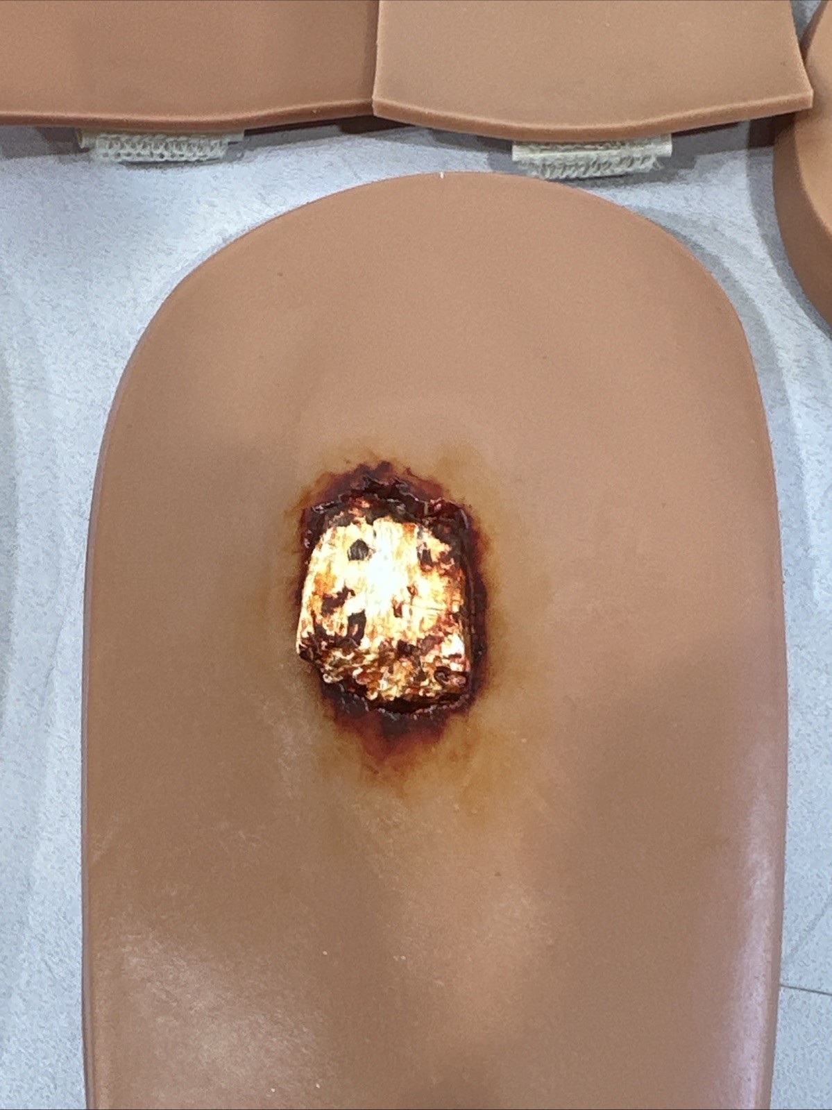 Traumatic Wound Simulation Set Of 14 For Education Medical Plastics Laboratory