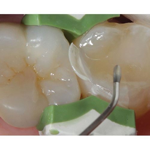NanoComp Dental Light Cured Universal Flowable Composite Resin 8x2g Shade A2