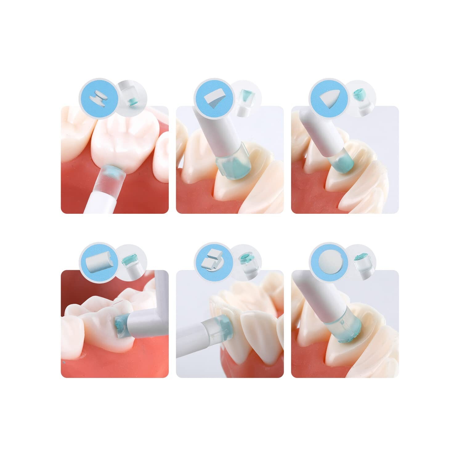 J&J Ortho Dental Orthodontic Smart Mold Assorted Kit (6/pk)