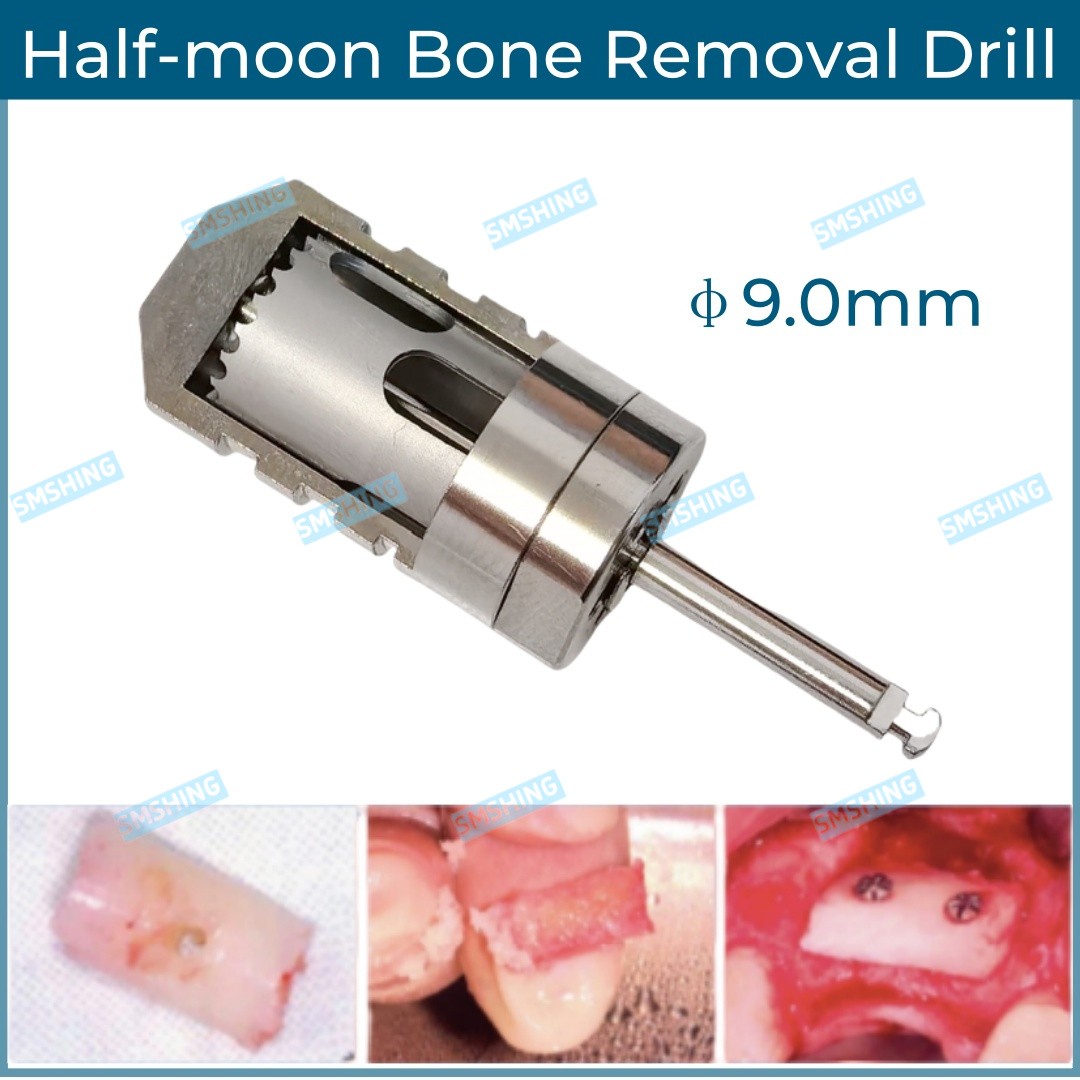 Dental Half Month Bon Drill Sampling Trephine Bur Incremental Bon Slice 9.0MM