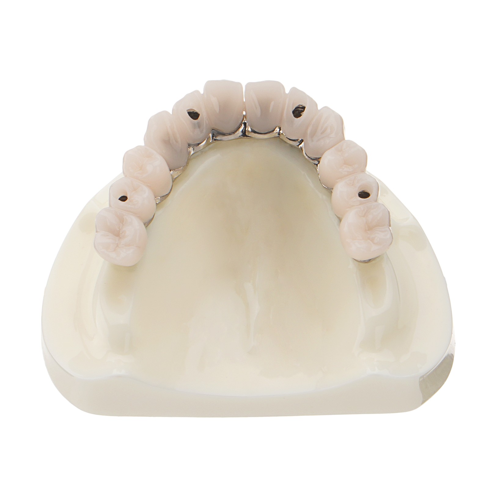 M6023 Dental All-on-4 Overdenture Model Upper Jaw Implants Restoration 4 Screws