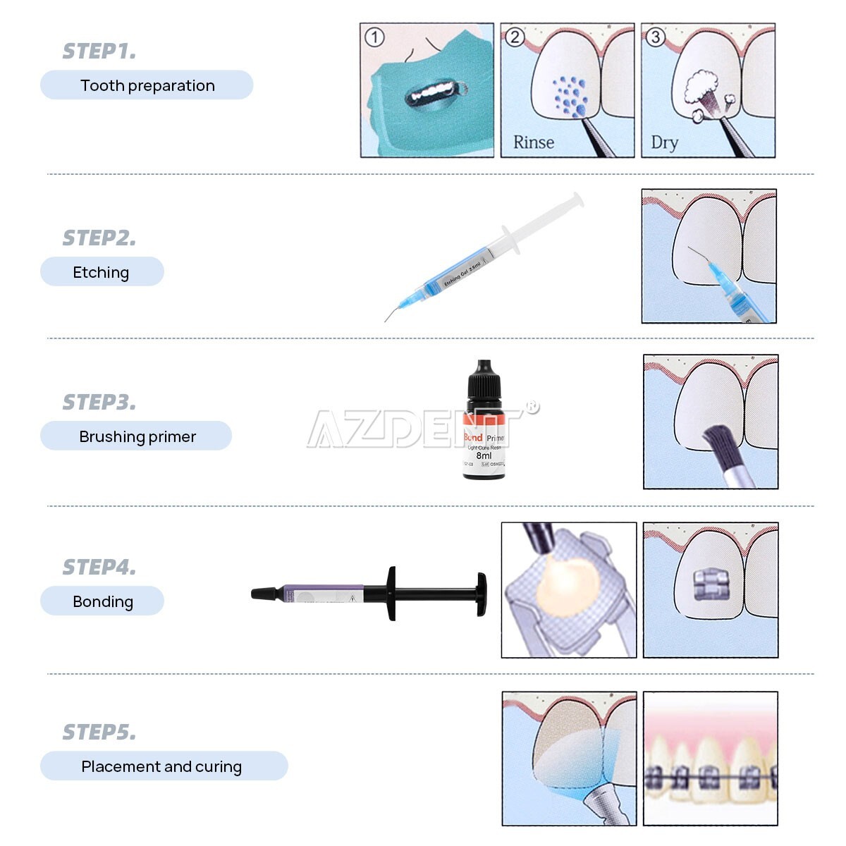 Dental Bracket Braces Glue Ortho Bonding Agents Light Cure Resin Composite Kit