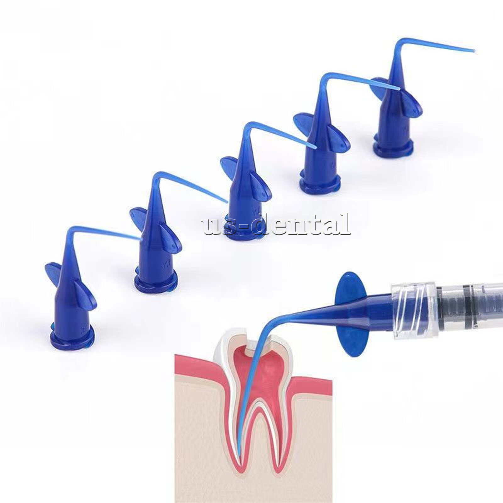 Dental Endo Irrigation Needle Syringe Tips Disposable Irrigator Tip 0.25/0.35mm