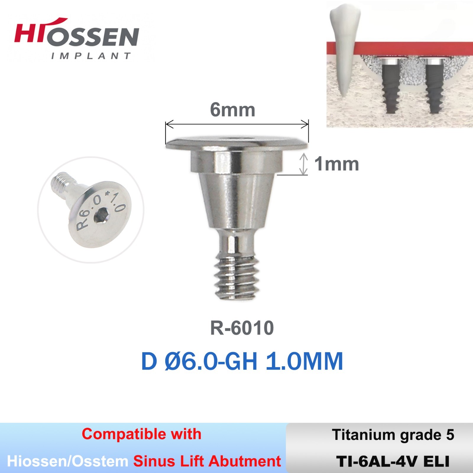 Dental Sinus lift Temporary Abutment Titanium Abutment fit to Den-tium Superline