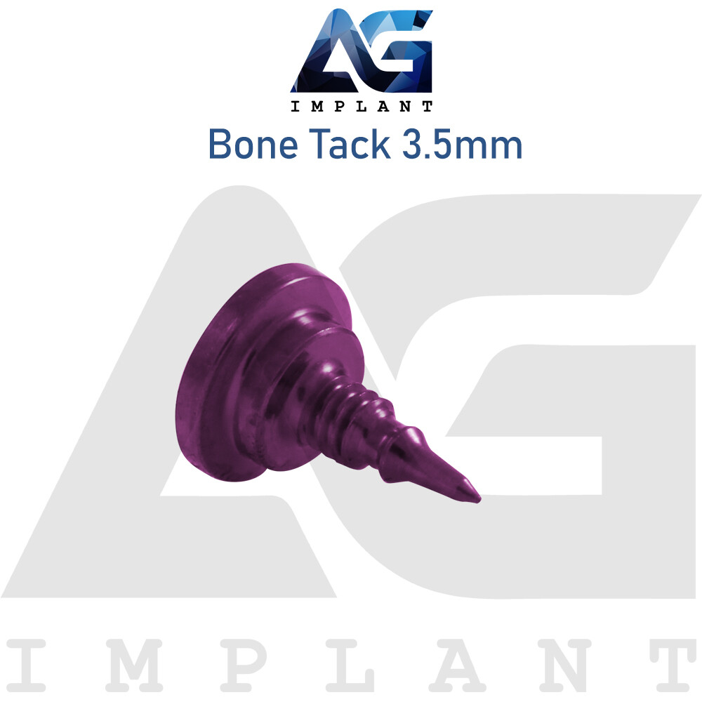 10 Titanium Tack Screw Guided Regeneration GBR Dental Membrane Fix System