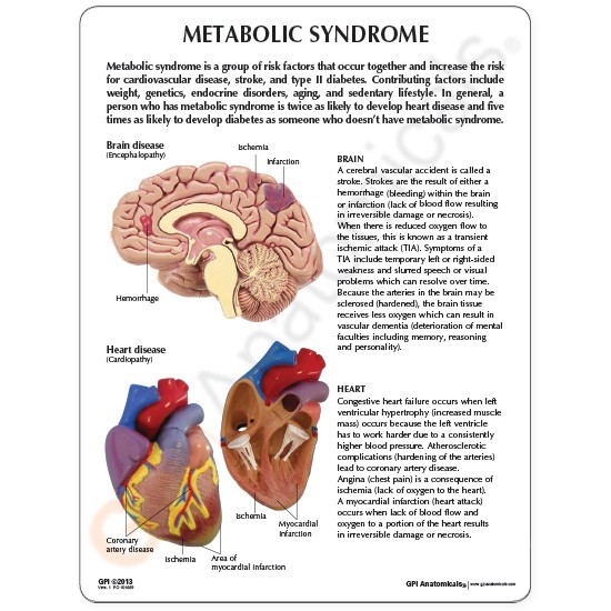 Metabolic Syndrome GPI Organ Model Set LFA#4020 Make Us an Offer! SEE VIDEO