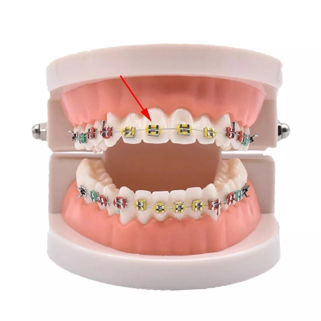 Braces Rubber Band Ligas Para Brackets Ortodoncia Braces Rubber Band Tool Bra…
