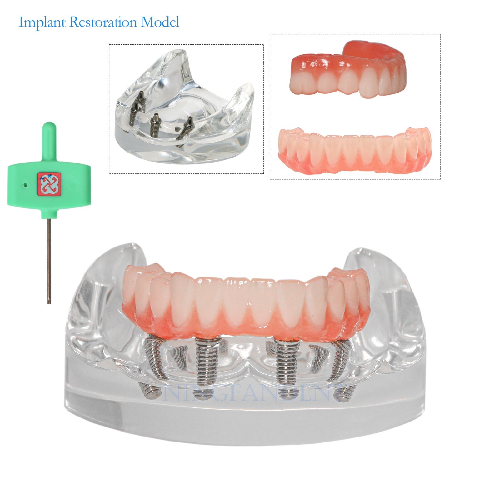 Dental Transparent Lower Jaw Malone Bridge All-on-4 Overdenture Typodont Model
