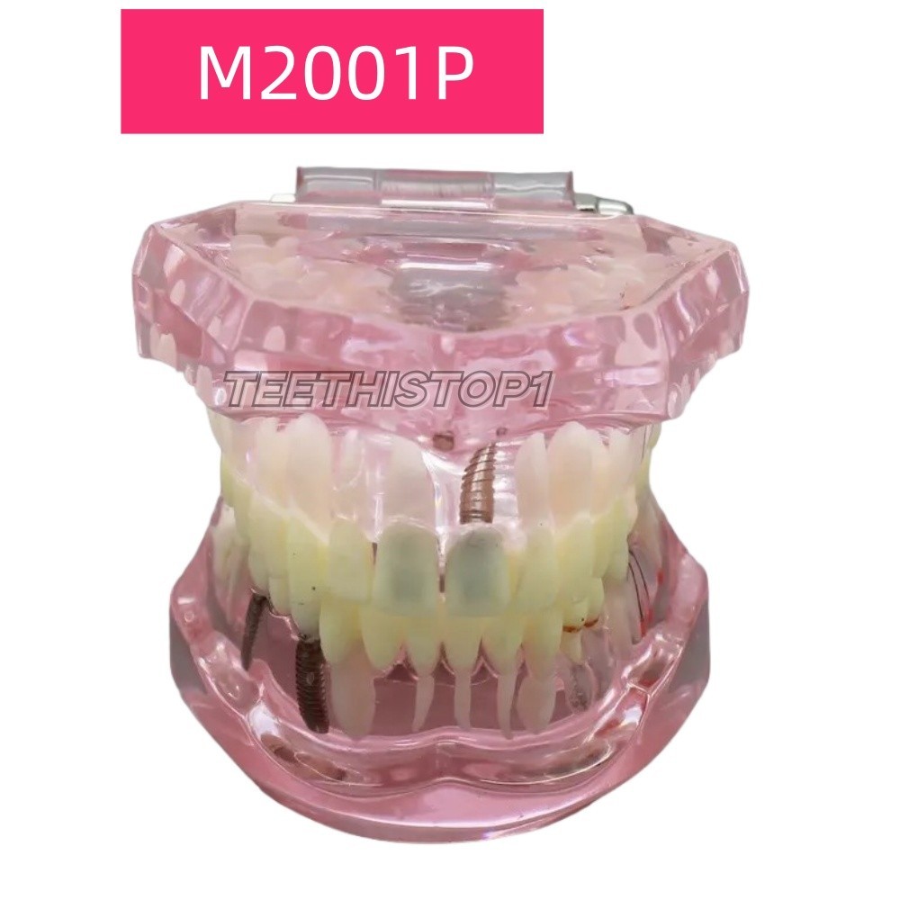 Dental teeth Model Preparation Training Teaching Ortho Implant Typodont Demo
