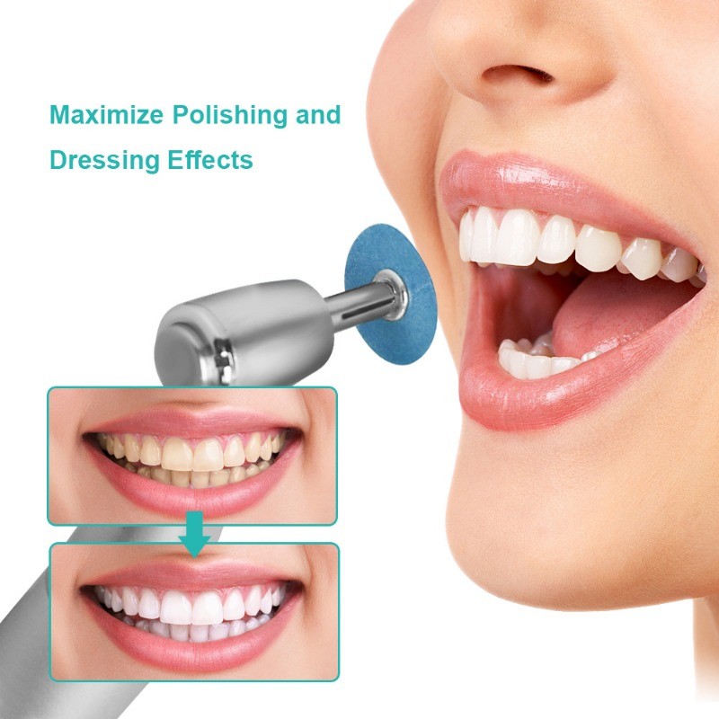 40pcs Dental Composite Polishing Kit 12mm/14mm Finishing Discs, Strips & Mandrel