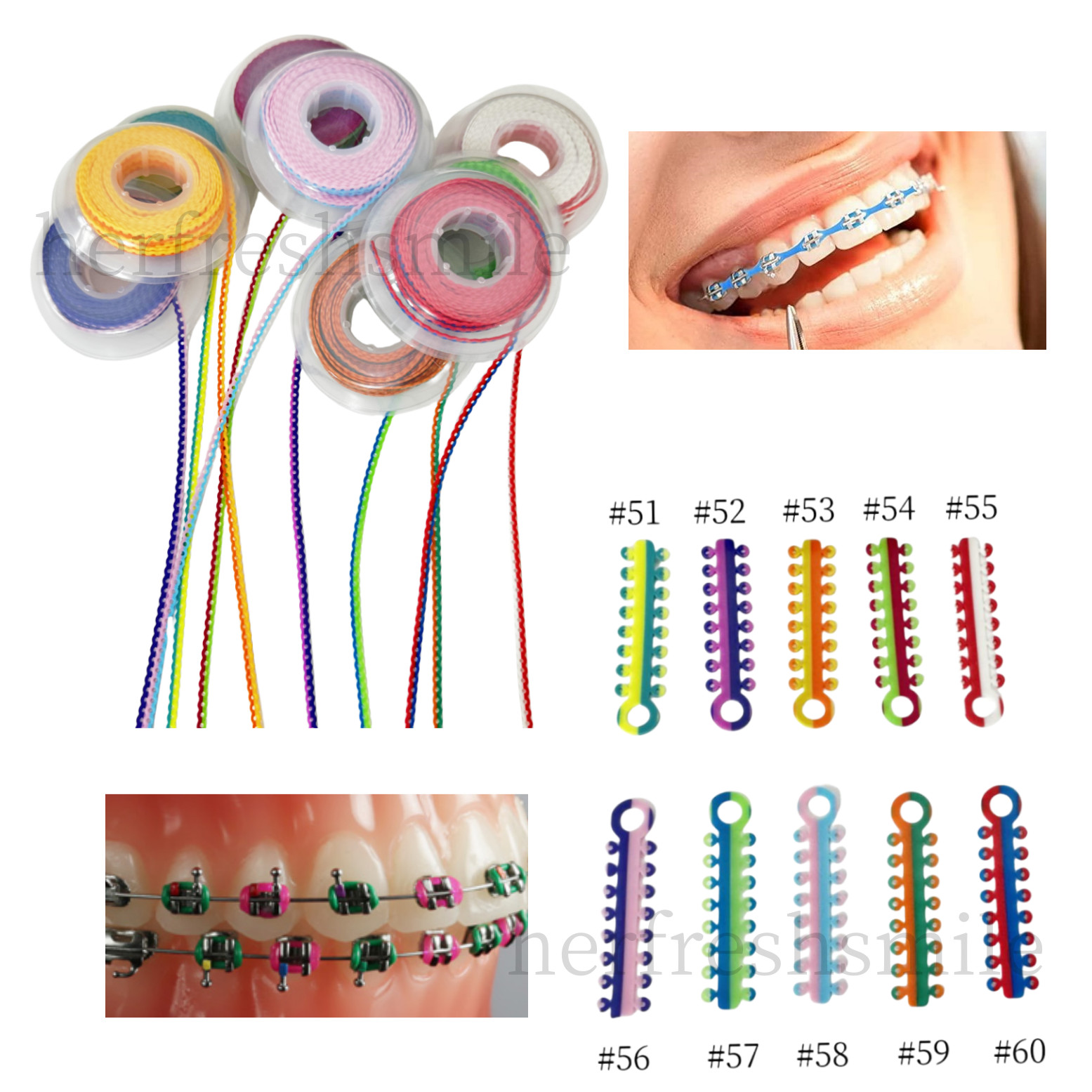 Double Color Dental Orthodontic Elastic Ligature Tie Rubber Bands Power Chains