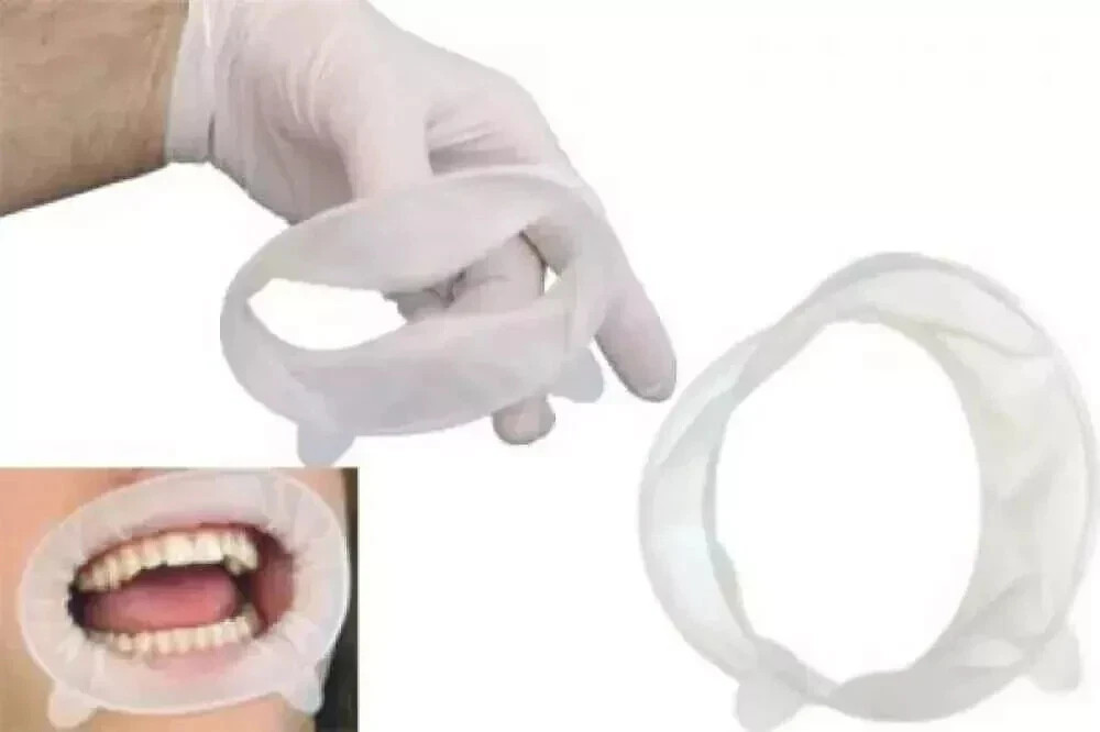 5 x Ivoclar OPTRAGATE 3D Mouth Opener Cheek & Lip Retractor All Sizes FREE SHIPP