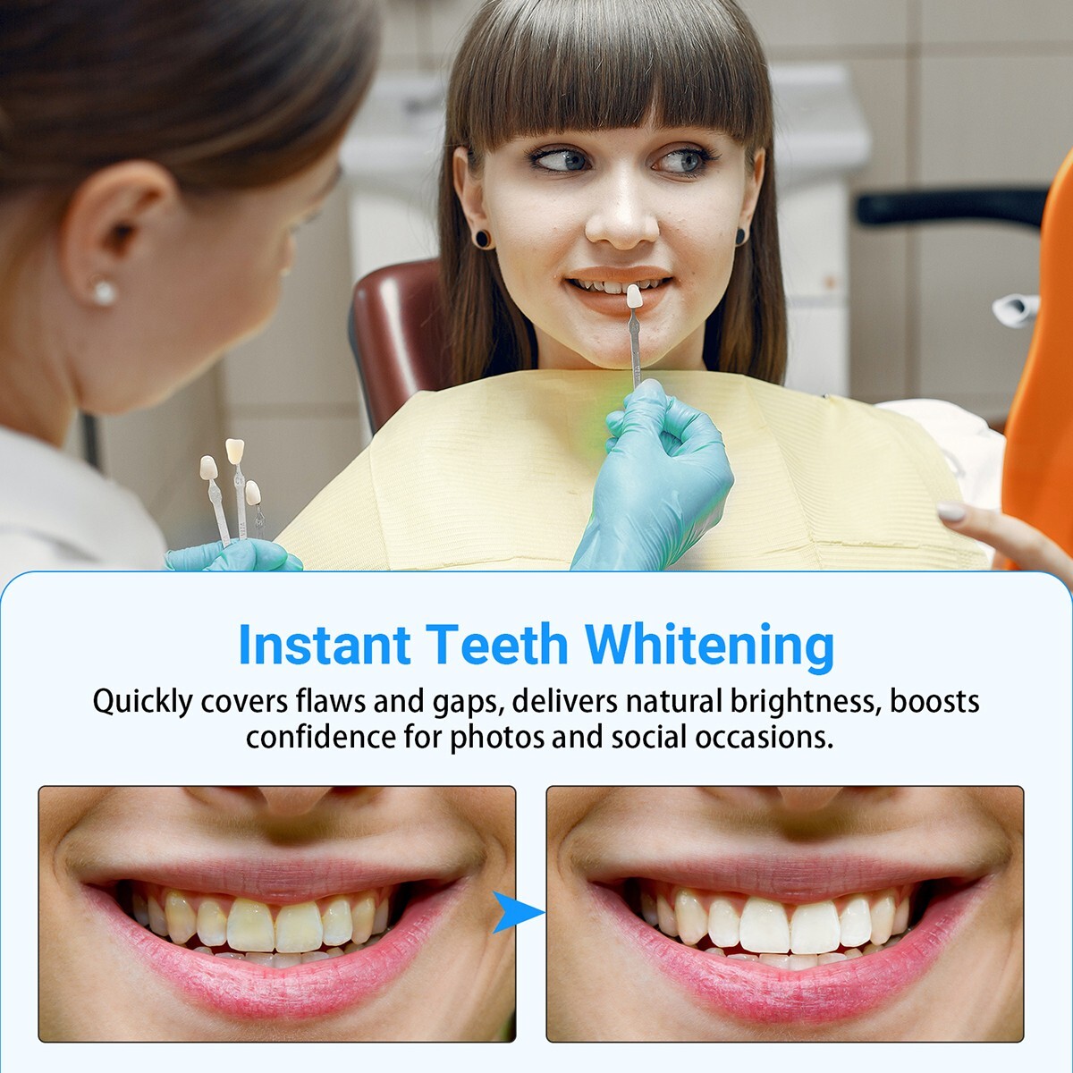 Dental Temporary Porcelain Crown /Teeth Veneers Thin Whitening Resin Anterior