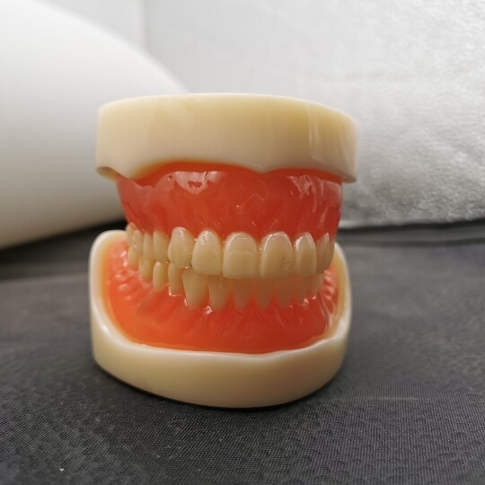 Dental 2 Implants Overdenture Typodont Restoration Upper Lower Lower Teeth Model