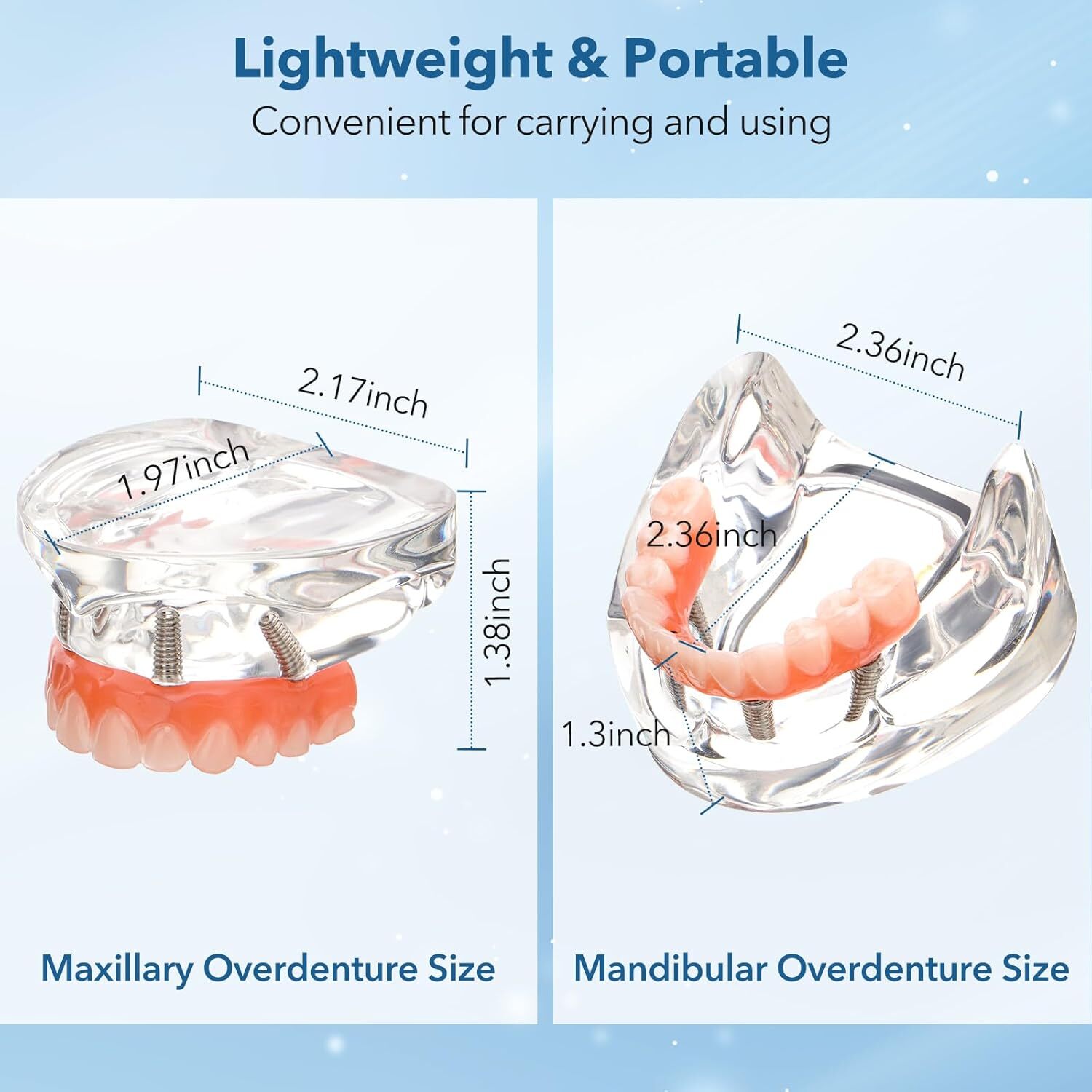 US Dental Overdenture Implant All-on-4 Upper/Lower Clear Jaw Model With 4 Screws