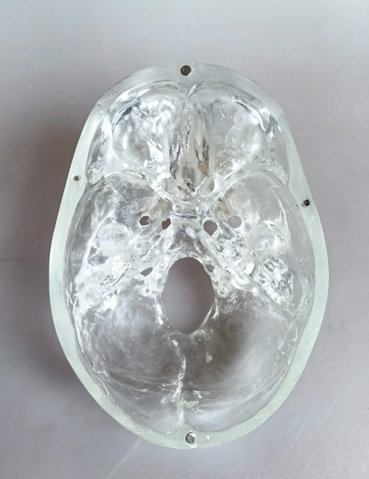 1:1 Human Upper Jaw Bone With Nerve Vessels Medical Anatomical Model