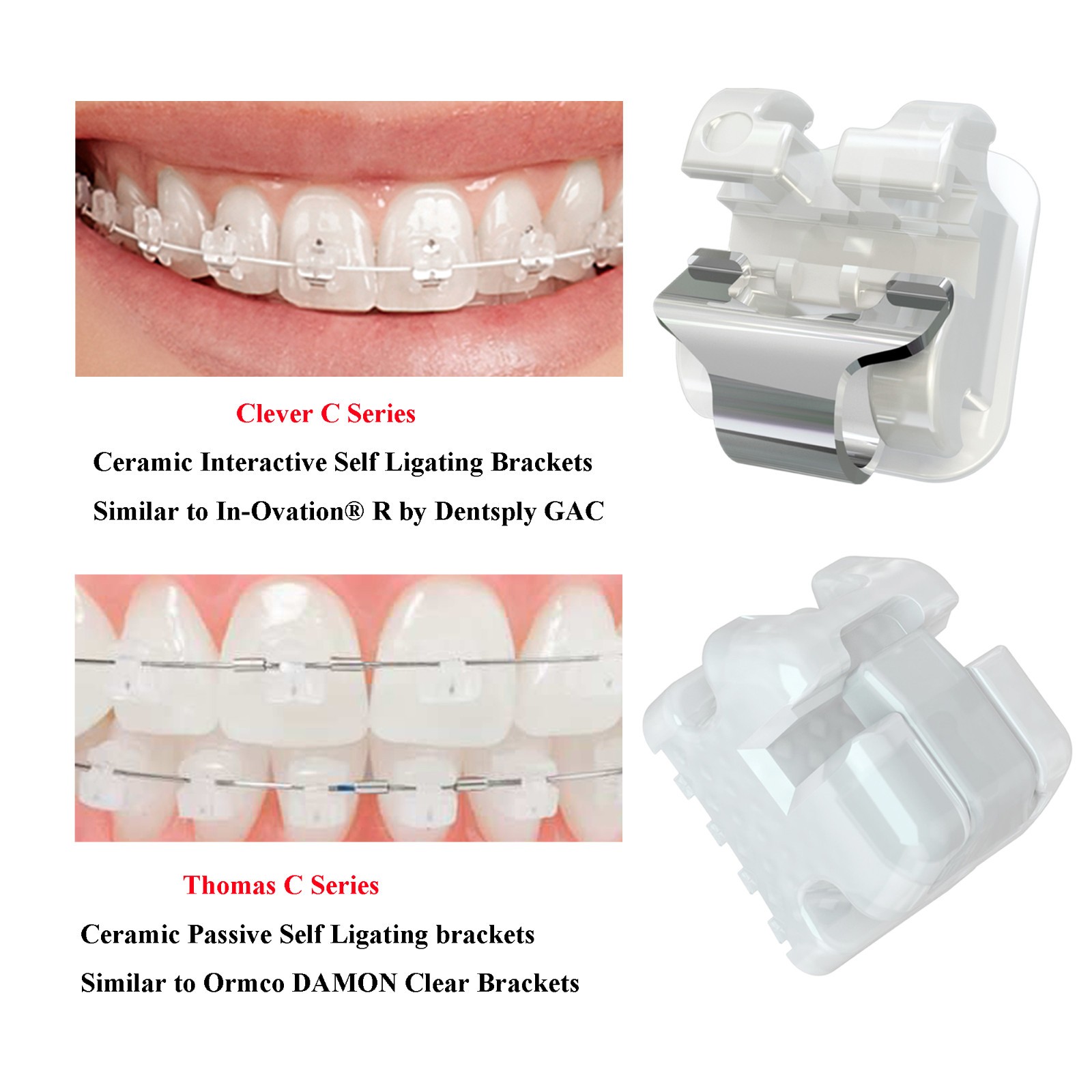 Orthodontic Brackets Clever Thomas Metal Damon AO Empower Self Ligating Braces