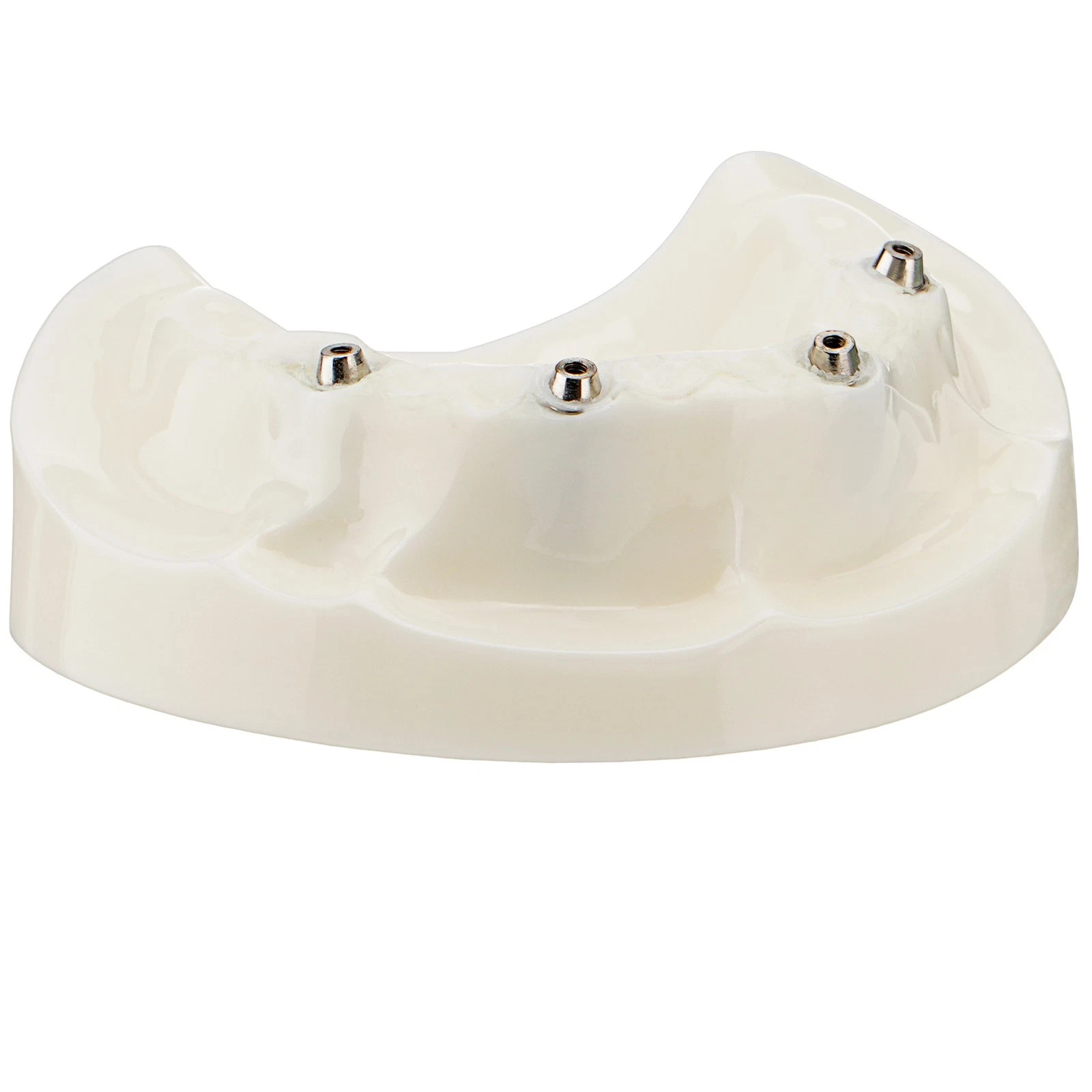 All-on-4 Dental Overdenture Model Dental Upper Jaw Implants Restoration 4 Screws