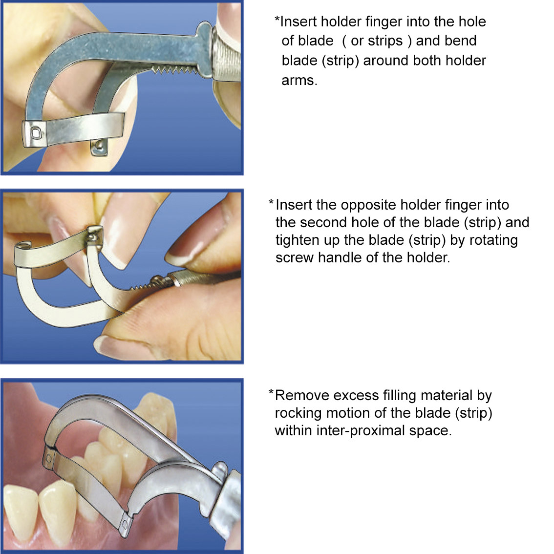 LOTx3 Dental proxicut holder restorative orthodontic composite crown