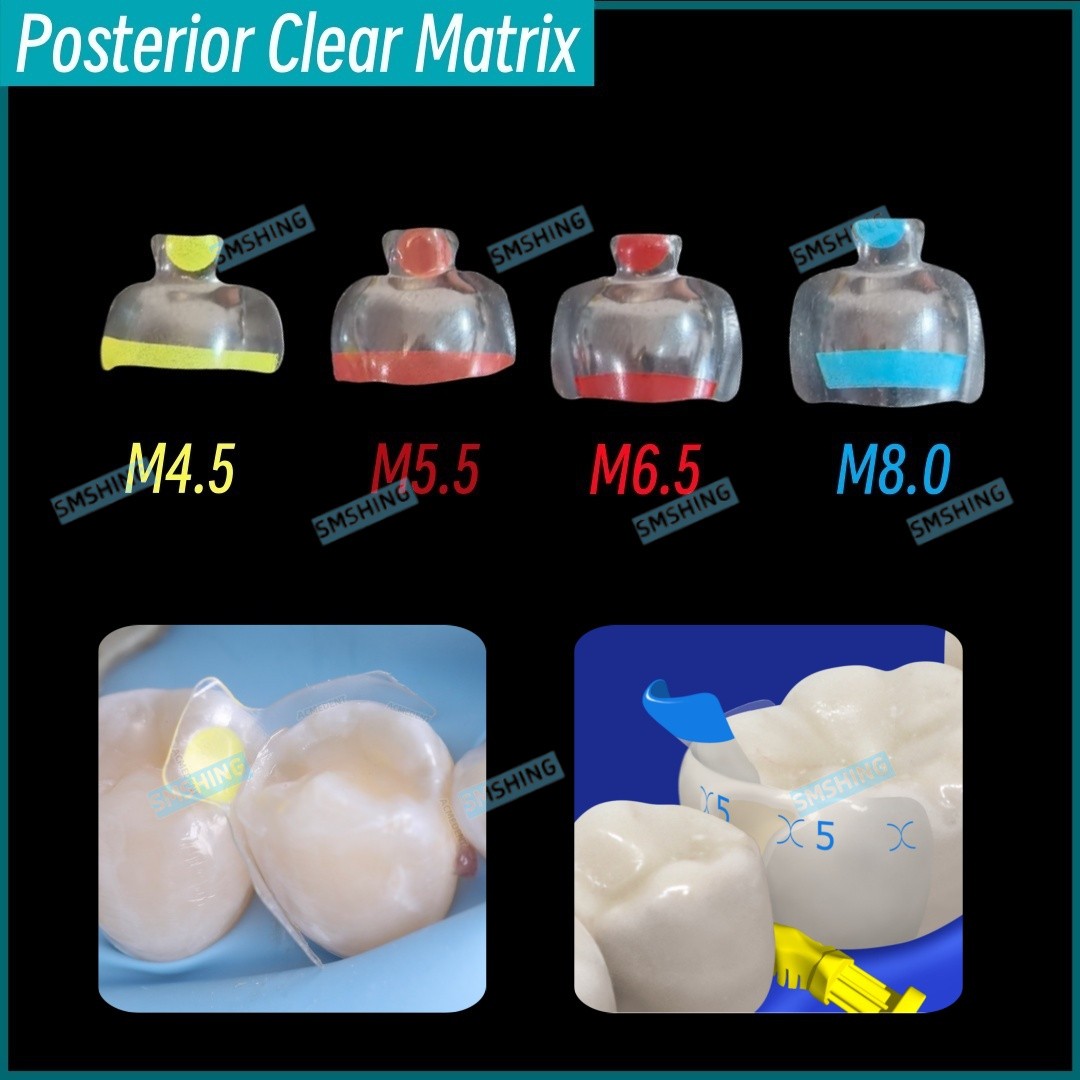 5Pcs Dental Clear Matrix Posterior Restorative BT Bow Matrices Fit BioClear