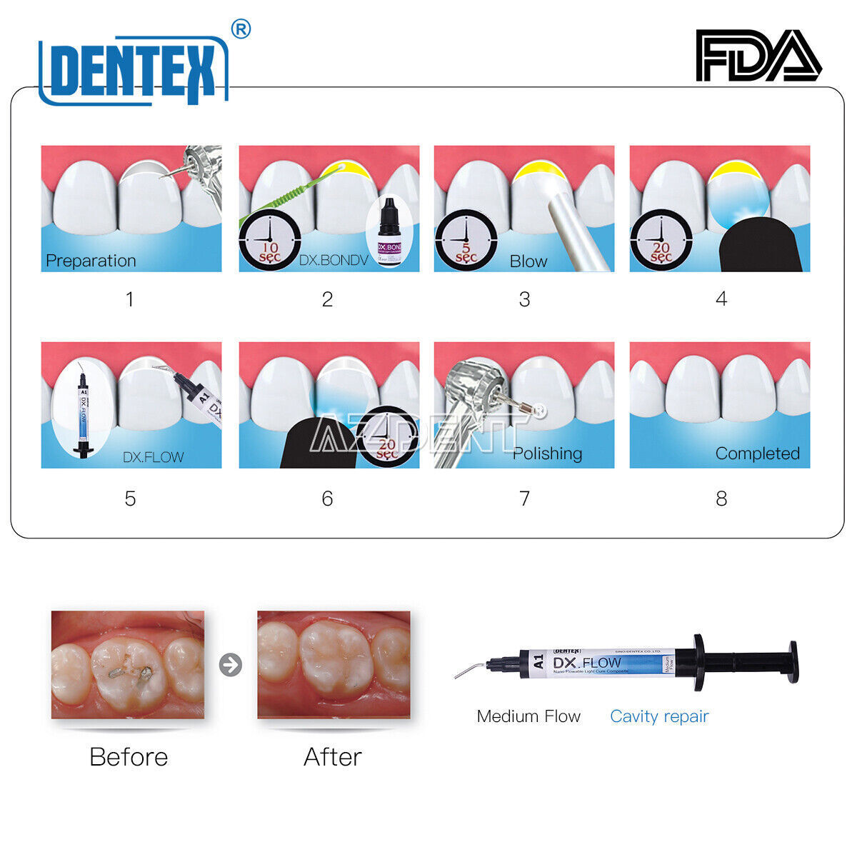 10X Dental Light Cure Composite Resin Flowable Medium Flow A1 3g/Syringe DX.FLOW