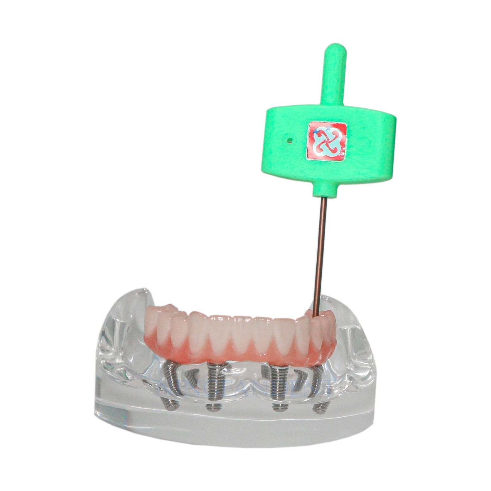 Dental Transparent Lower Jaw Malone Bridge All-on-4 Overdenture Typodont Model